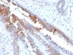 Mammaglobin A Antibody (MGB/2123R) - Azide and BSA Free, Novus Biologicals